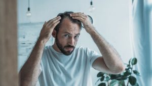 Detailed image of a patient’s scalp post-hair transplant surgery, highlighting successful follicle placement and recovery progress.